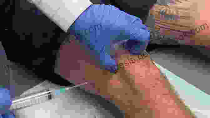 Intra Articular Injections Being Administered Into A Knee Joint Intra Articular Allied Injections